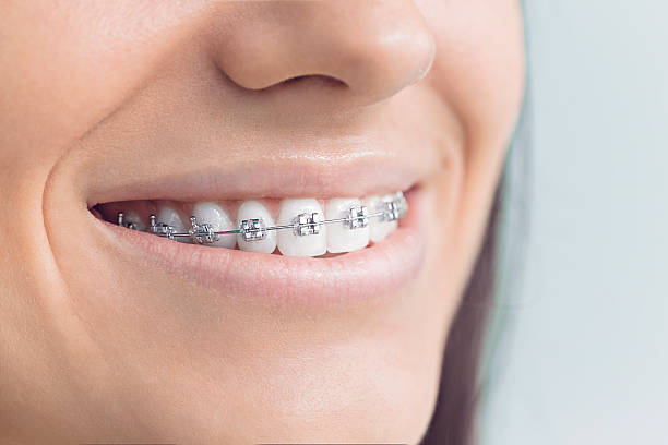 Best Dentures (Full and Partial)  in , AZ